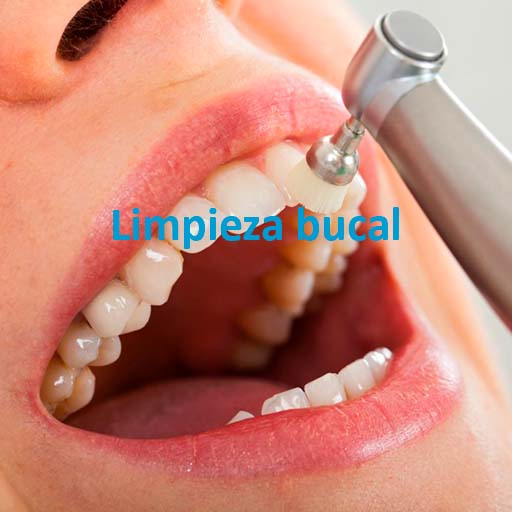centro dental javier alvarez limpieza bucal