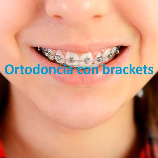 centro dental javier alvarez ortodoncia brackets