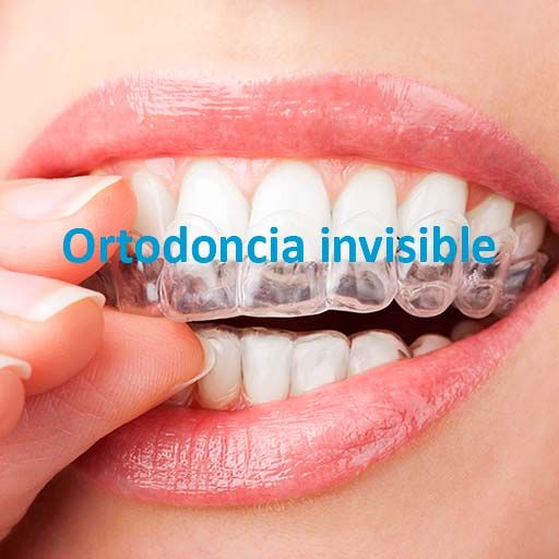 centro dental javier alvarez ortodoncia invisible